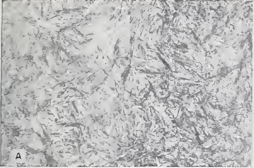 NBS Figure 15A: high-carbon steel quenched in brine, identified in the original source as martensite.
