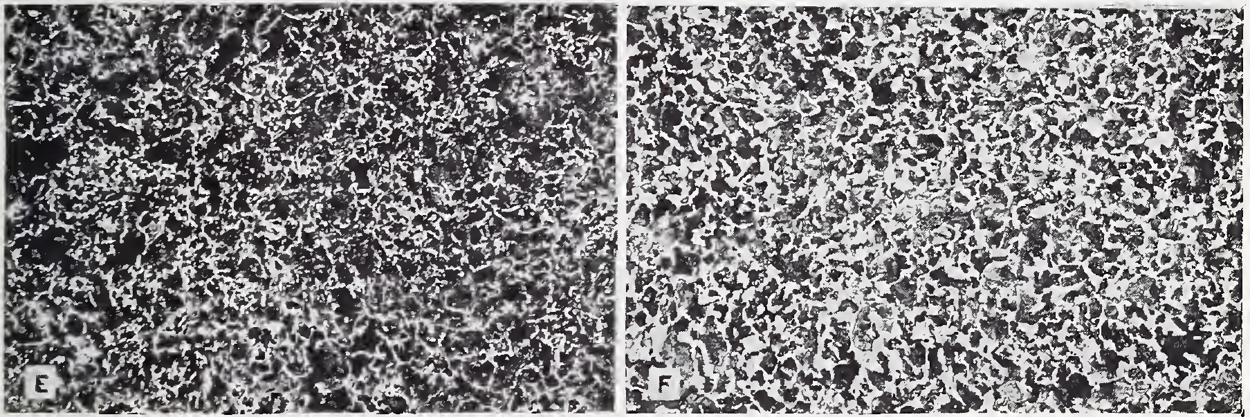 NBS Figure 12E and 12F: centre microstructures of quarter-inch and two-and-a-half-inch rounds of 0.5 percent carbon steel after normalizing.